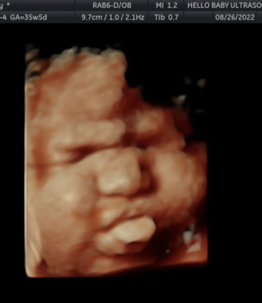 Gallery Hello Baby Blog